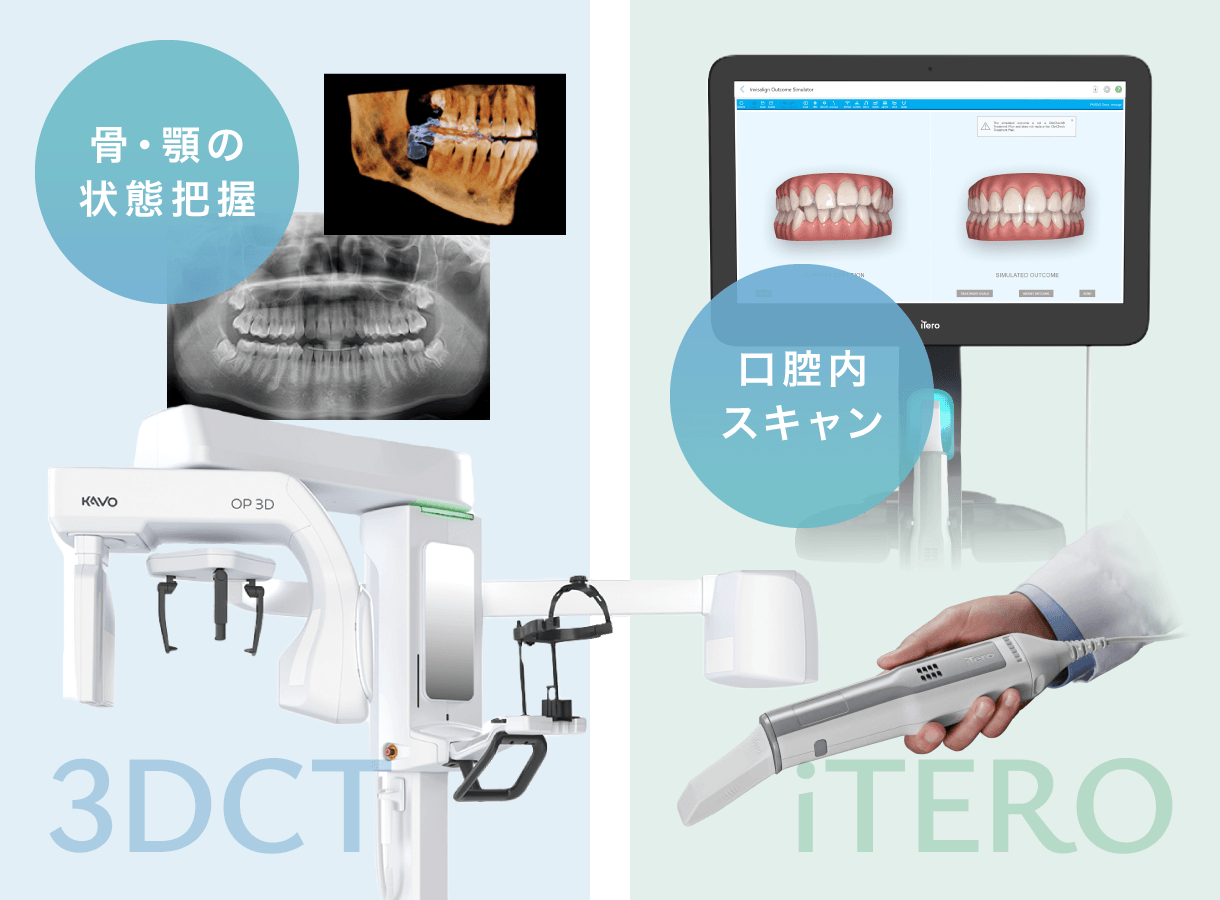 3DCT/iTERO