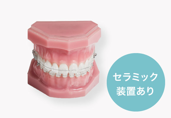 マルチブラケット