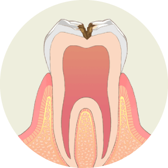 C1 / C2