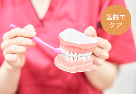 歯磨き指導(TBI)