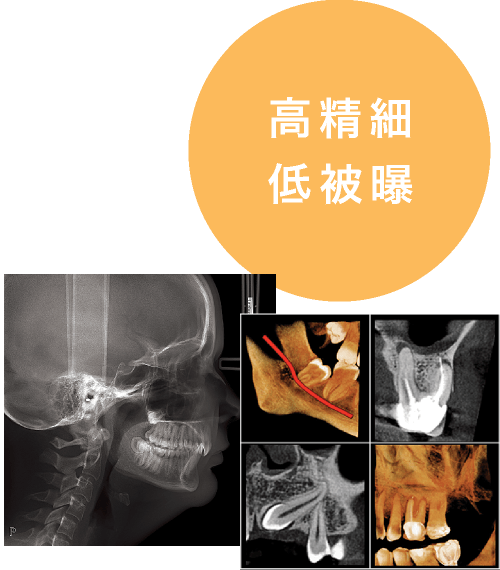 高精細/低被曝