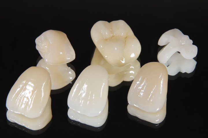 色々なセラミックの素材でできた歯
