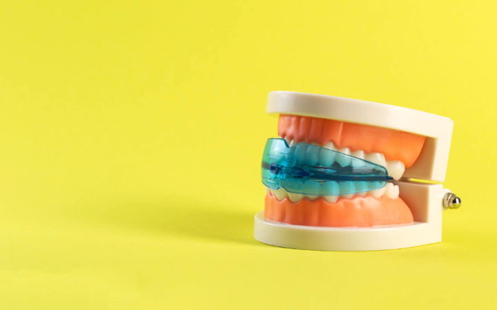 プレオルソをした歯の模型