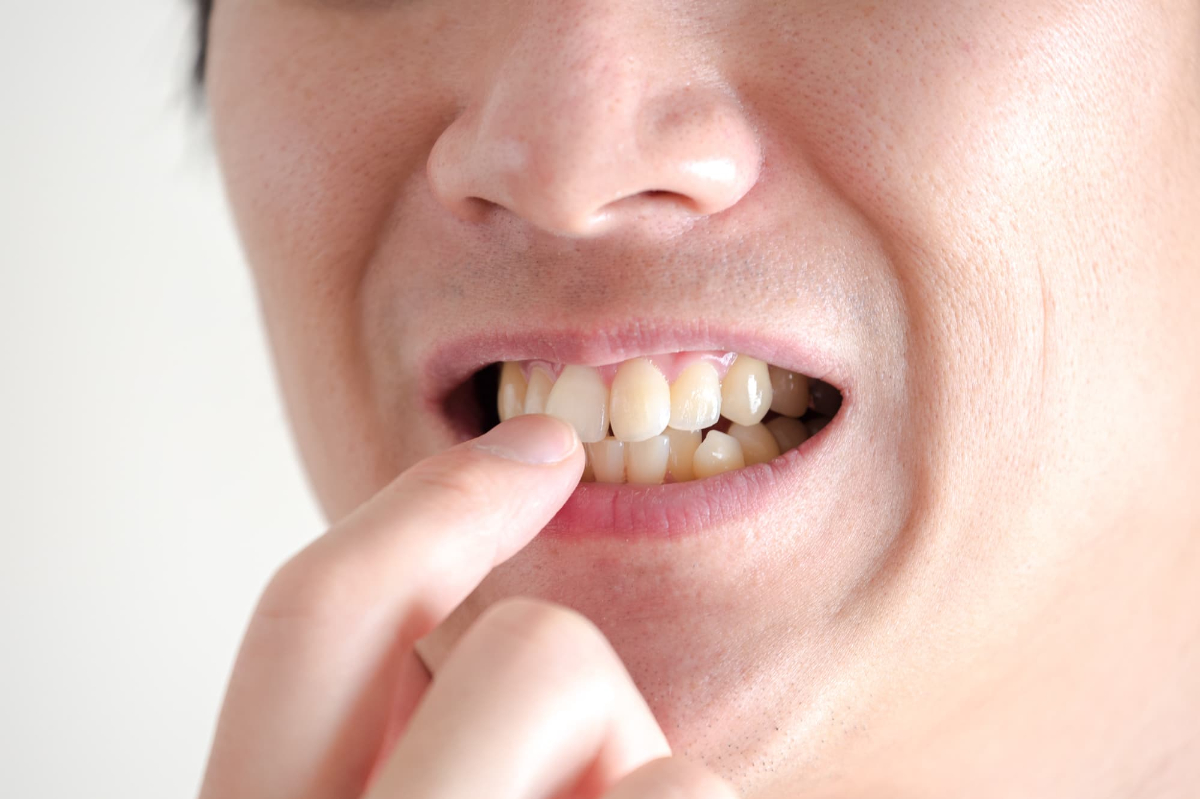 出っ歯が気になり指で触る男性